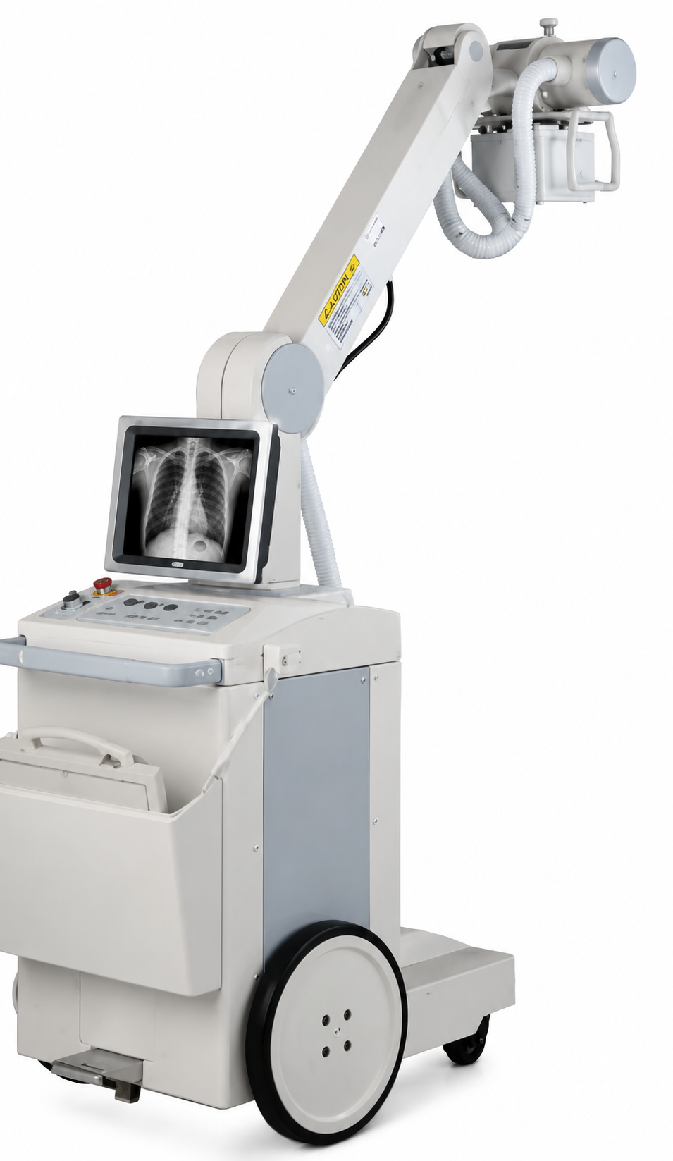 Mobiel DR system KCXR-14